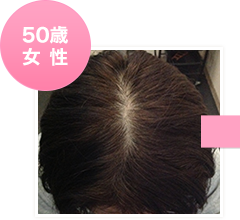 50歳女性初回