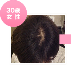 30歳女性初回