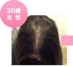 30歳女性初回