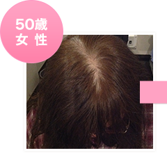 50歳女性初回