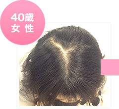 40歳女性初回