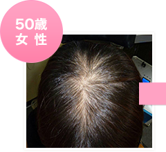 50歳女性初回